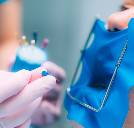Gloved hand holding a needle.